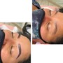 Back Facial