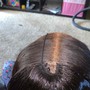 Scalp Treatment