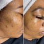 Back Facial Favor