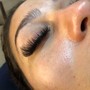 Eyelash Removal