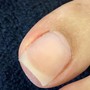 Encapsulated Nail