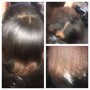 Scalp Treatment