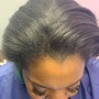 Scalp Treatment