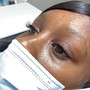 Eyelash Extension Removal