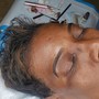 Brow shaping