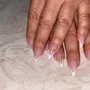 Nail removal with service