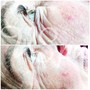 BOTOX GLOWTOX FACIAL