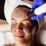 Microdermabrasion Treatment