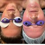 Oxygen Facial