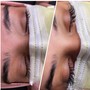 Eyelash Extension Removal