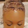 Scalp Treatment