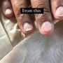 Nail Repair