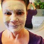 Chemical peel