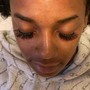 Eyelash Extension Removal