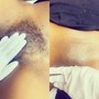 Underarm Wax