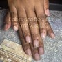 Gel Overlay