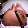 Dermaplaning Glow