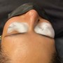 Pro MicroNeedling