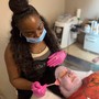 Microdermabrasion facial