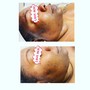 Oxygenating Facial