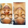 Botinol facial