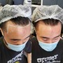 SCALP MICROPIGMENTATION [SMP] starting at $700 [CALL FOR ESTIMATE] AND BOOK APPOINTMENTS...200 DEPOSIT REQUIRED