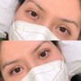 Lash Lift Reversal