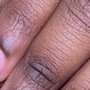 Callus Removal