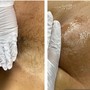 Half Arm Wax