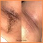 Vagacial and  Brazilian Wax