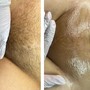 Brazilian Wax & Under Arm Special