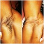 Brazilian Wax