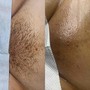 Underarm Wax