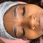 Chemical peel