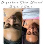 Signature Maskne Treatment Facial