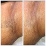 Vajacial without Brazilian wax