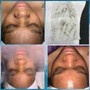 Clarifying Back Facial