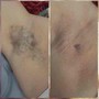 Underarm Wax