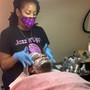 Dermaplaning