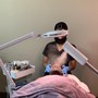 Microdermabrasion Facial