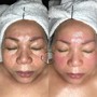 Back Facial