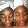 Blemish AND Balance Facial