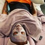 Lactic Acid Peel