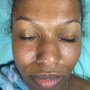 Glycolic Peel