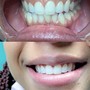 Couples /Friends Whitening Session