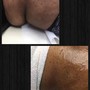 Men’s Brazilian Wax