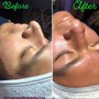 Facial