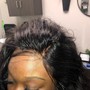 Scalp Treatment