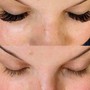 Eyelash Extension Removal