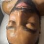 Peach Facial (Buttocks)